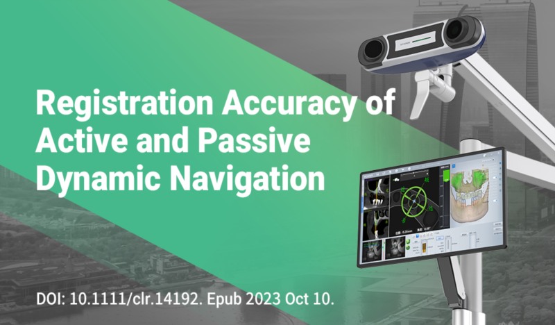 Accuracy of different registration areas using active and passive dynamic navigation systems in dental implant surgery: An in vitro study