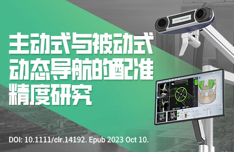 不同配准区域在主动式与被动式动态导航系统牙种植手术中的精度比较：一项体外研究