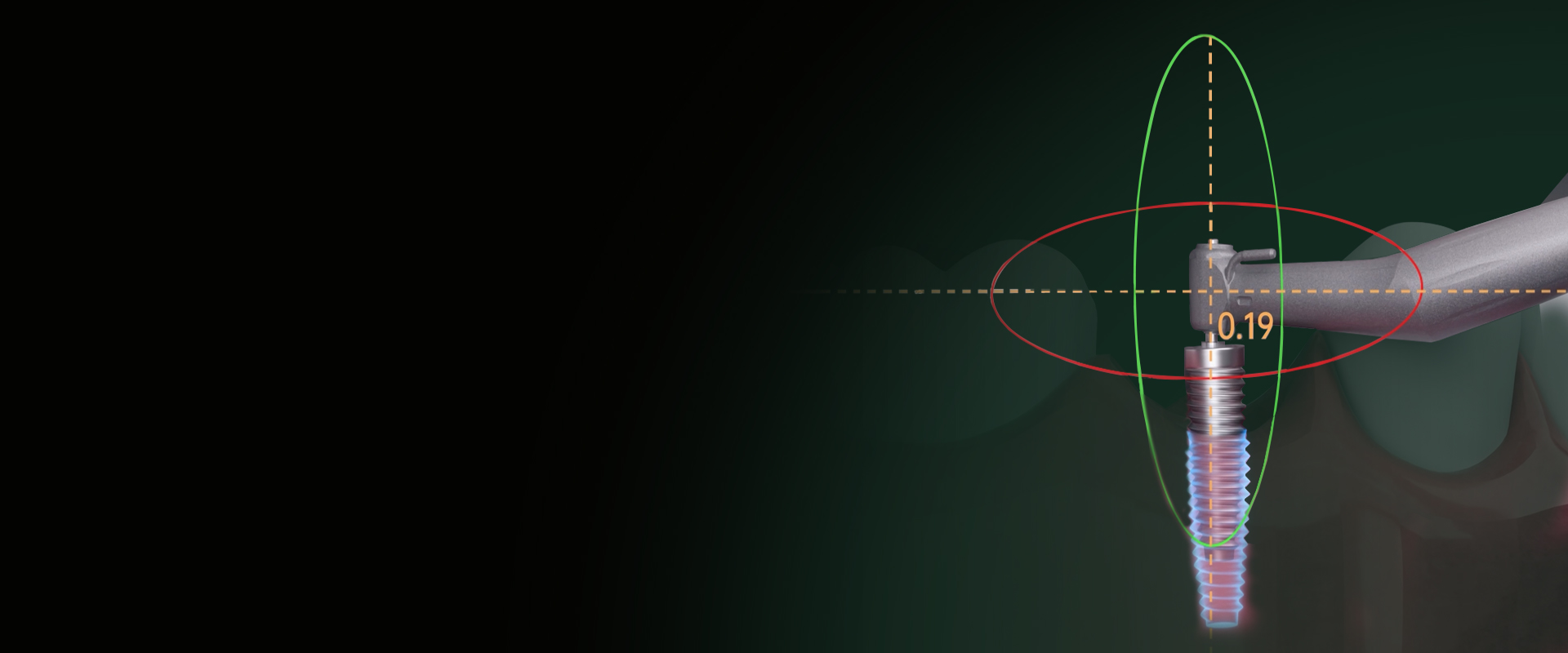 area-2-img.jpg